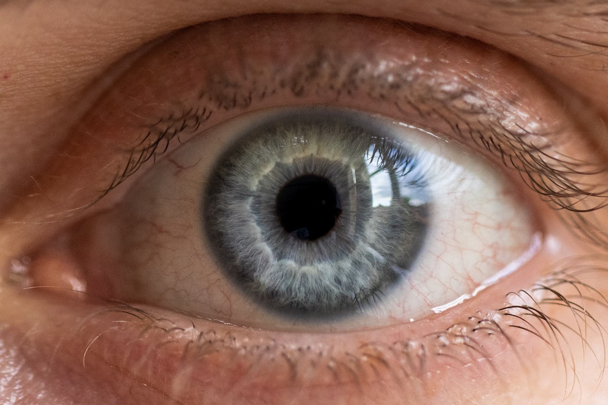 Análise de olheiras e bolsas sob os olhos